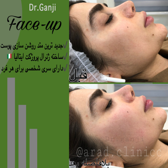 فیس آپ 