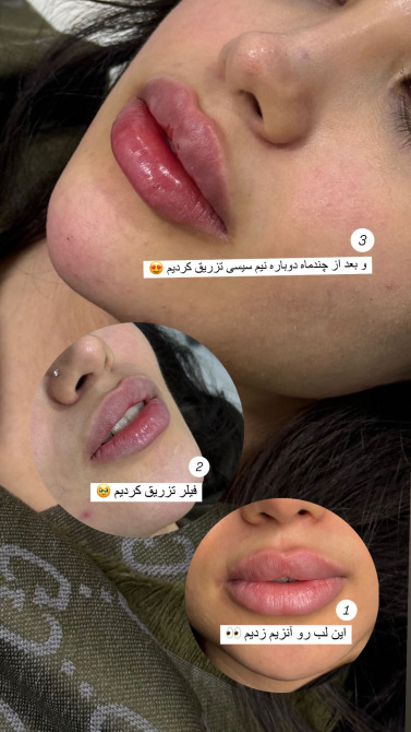 لب