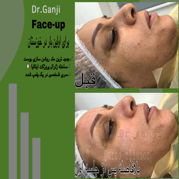 فیس آپ