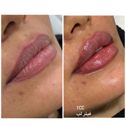 لب نچرال