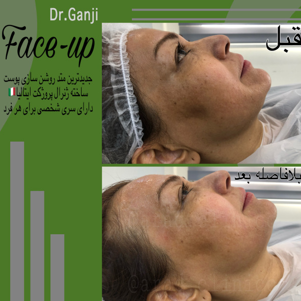 فیس آپ 